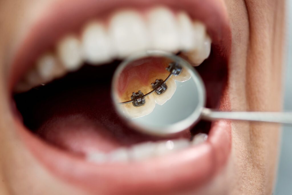 Vegas Dentist